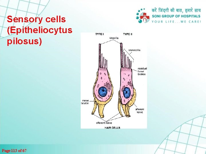 Sensory cells (Epitheliocytus pilosus) Page 113 of 67 