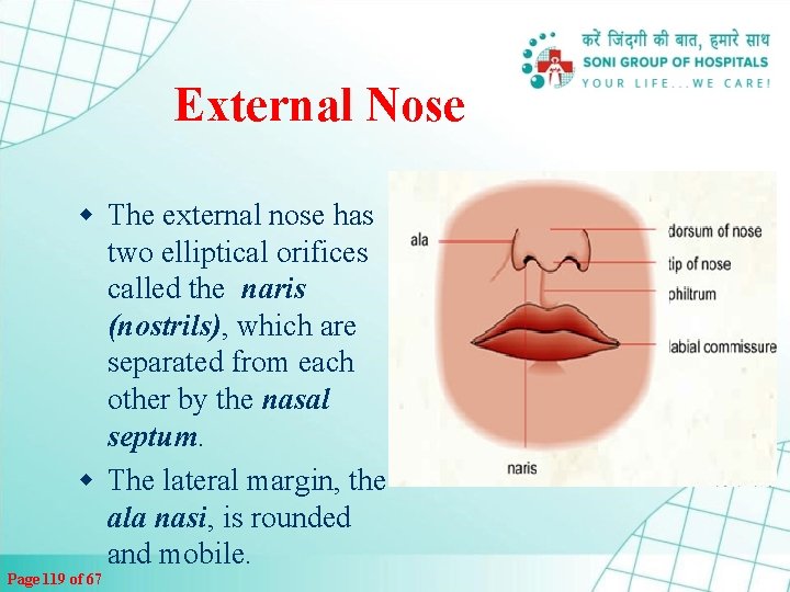 External Nose w The external nose has two elliptical orifices called the naris (nostrils),