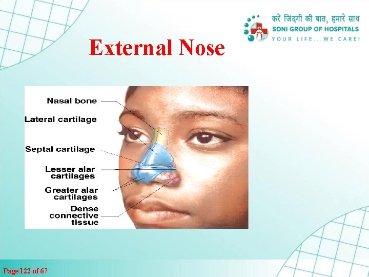 External Nose Page 122 of 67 