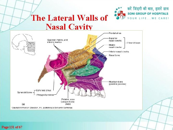 The Lateral Walls of Nasal Cavity Page 131 of 67 