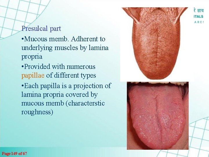 Presulcal part • Mucous memb. Adherent to underlying muscles by lamina propria • Provided