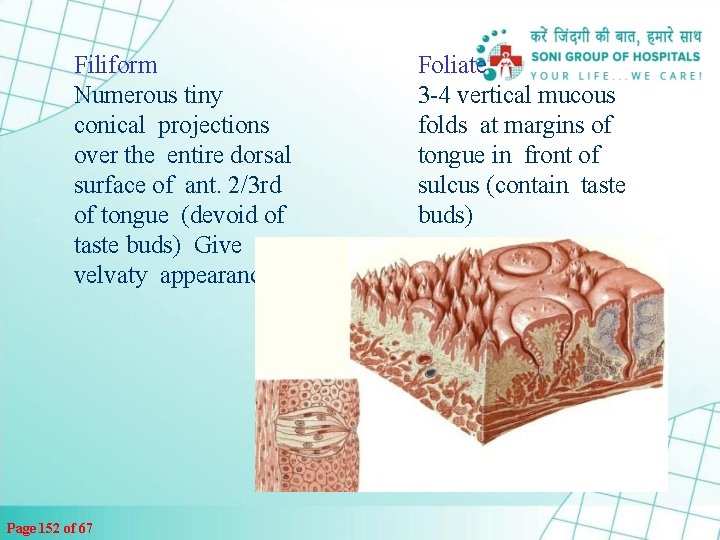 Filiform Numerous tiny conical projections over the entire dorsal surface of ant. 2/3 rd