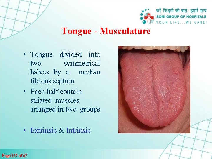 Tongue - Musculature • Tongue divided into two symmetrical halves by a median fibrous