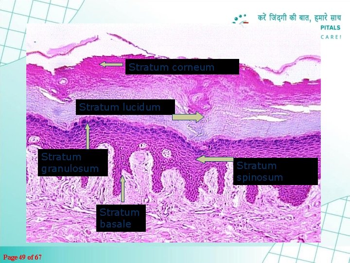 Stratum corneum Stratum lucidum Stratum granulosum Stratum spinosum Stratum basale Page 49 of 67