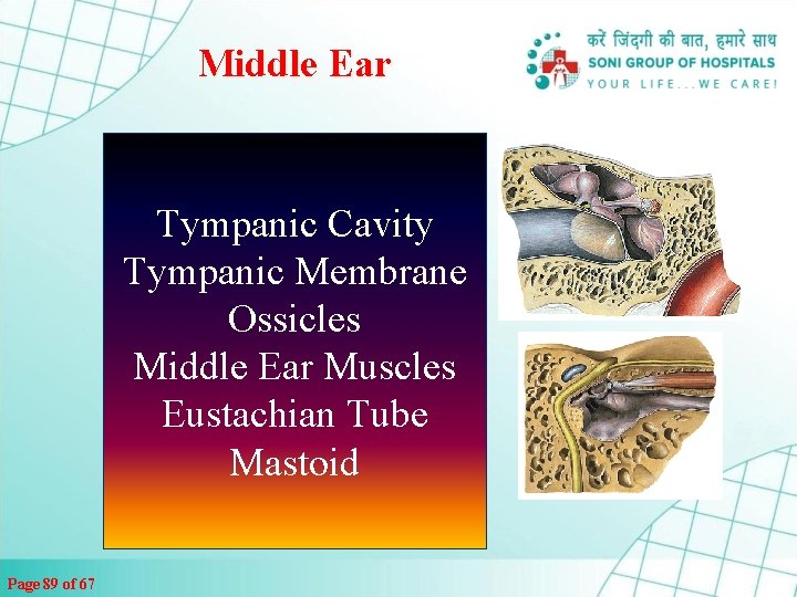 Middle Ear Tympanic Cavity Tympanic Membrane Ossicles Middle Ear Muscles Eustachian Tube Mastoid Page