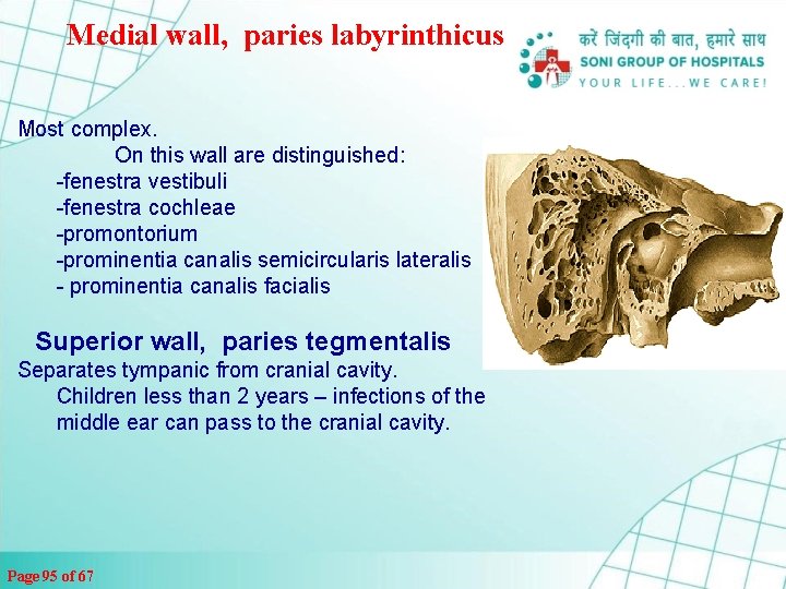 Medial wall, paries labyrinthicus Most complex. On this wall are distinguished: -fenestra vestibuli -fenestra