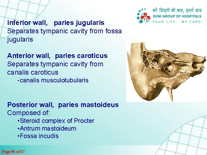 Inferior wall, paries jugularis Separates tympanic cavity from fossa jugularis Anterior wall, paries caroticus