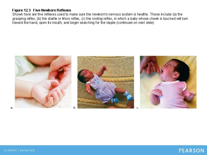 Figure 12. 3 Five Newborn Reflexes Shown here are five reflexes used to make