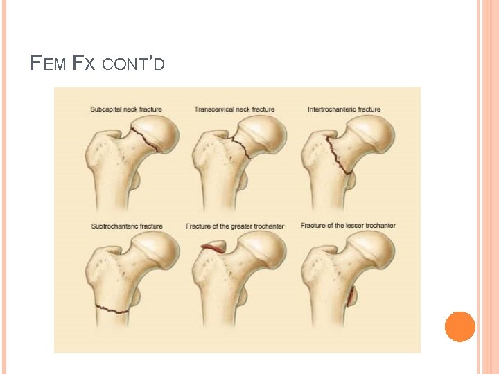 FEM FX CONT’D 