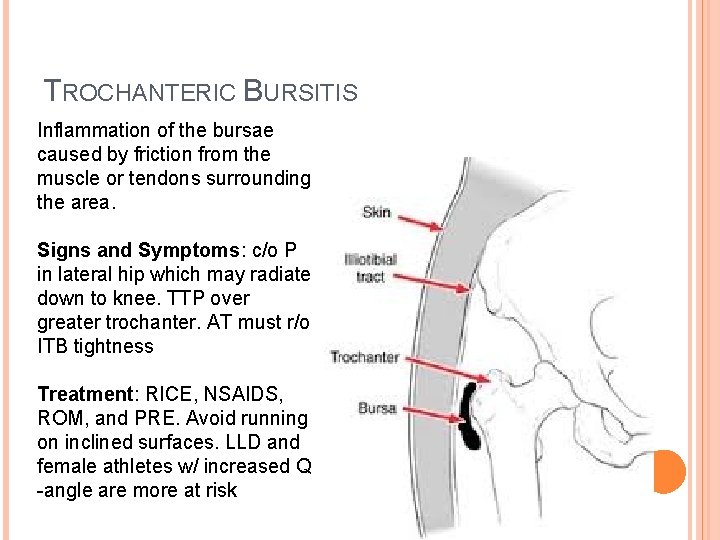 TROCHANTERIC BURSITIS Inflammation of the bursae caused by friction from the muscle or tendons TROCHANTERIC BURSITIS Inflammation of the bursae caused by friction from the muscle or tendons
