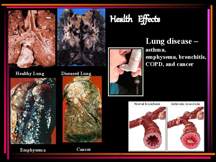Health Effects Lung disease – asthma, emphysema, bronchitis, COPD, and cancer Healthy Lung Diseased