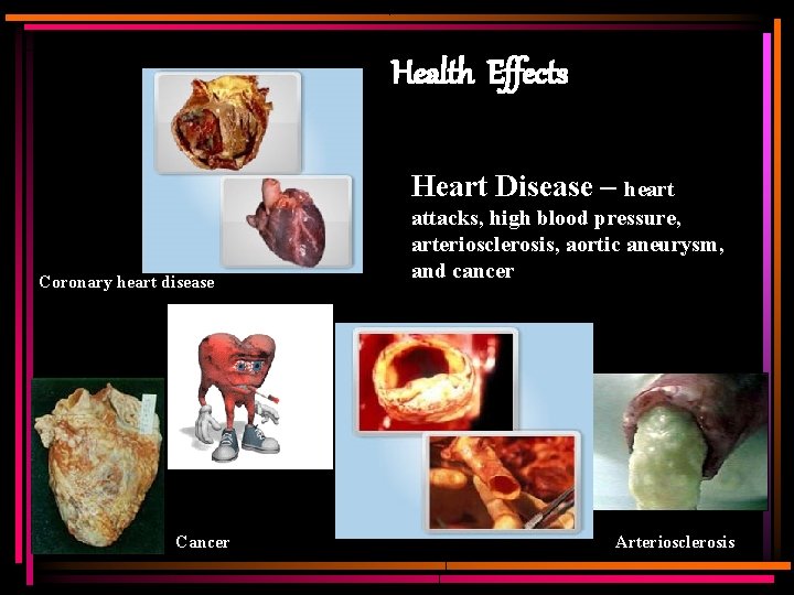 Health Effects Heart Disease – heart Coronary heart disease Cancer attacks, high blood pressure,