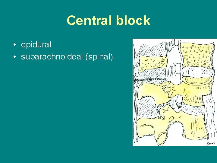 Central block • epidural • subarachnoideal (spinal) 