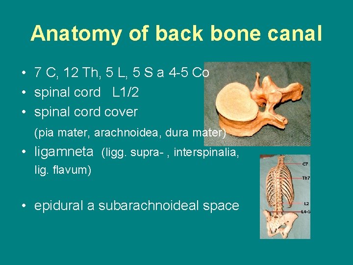 Anatomy of back bone canal • 7 C, 12 Th, 5 L, 5 S