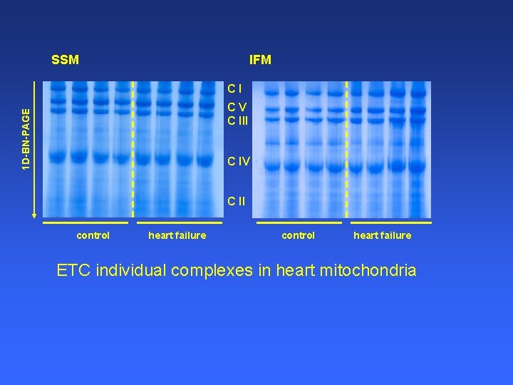 SSM IFM CI 1 D-BN-PAGE CV C III C IV C II control heart