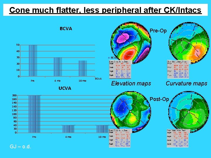 Cone much flatter, less peripheral after CK/Intacs BCVA Pre-Op 50 40 30 BCVA 20 Cone much flatter, less peripheral after CK/Intacs BCVA Pre-Op 50 40 30 BCVA 20