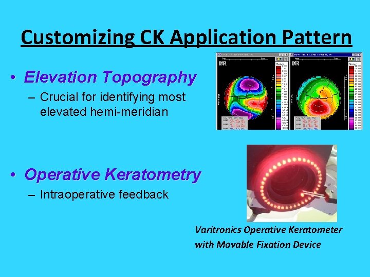 Customizing CK Application Pattern • Elevation Topography – Crucial for identifying most elevated hemi-meridian Customizing CK Application Pattern • Elevation Topography – Crucial for identifying most elevated hemi-meridian