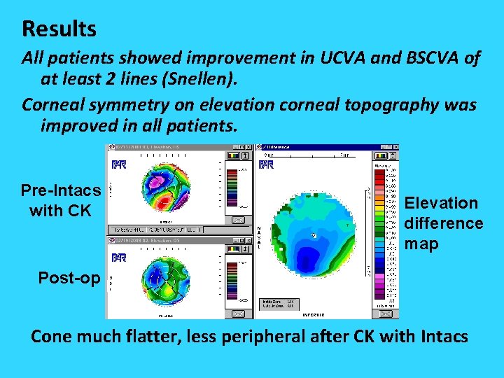 Results All patients showed improvement in UCVA and BSCVA of at least 2 lines Results All patients showed improvement in UCVA and BSCVA of at least 2 lines