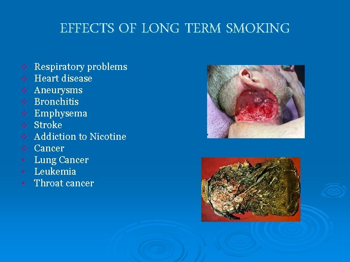 EFFECTS OF LONG TERM SMOKING v v v v w w w Respiratory problems