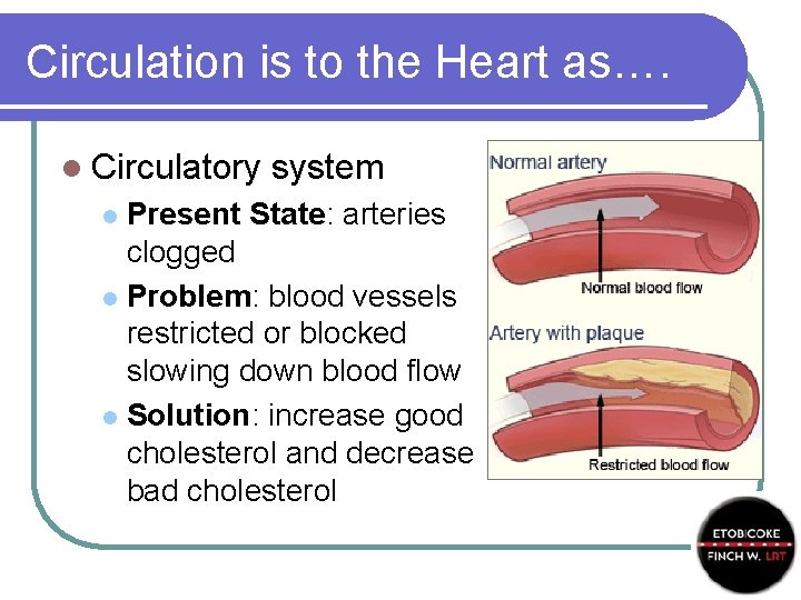Circulation is to the Heart as…. l Circulatory system Present State: arteries clogged l