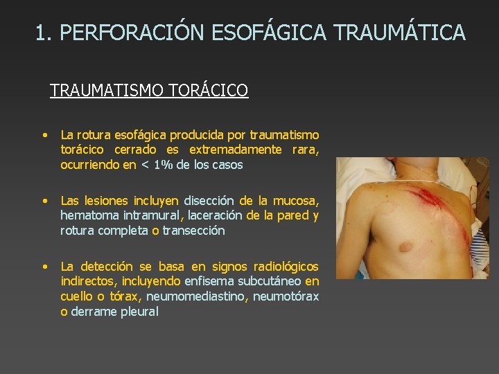 1. PERFORACIÓN ESOFÁGICA TRAUMÁTICA TRAUMATISMO TORÁCICO • La rotura esofágica producida por traumatismo torácico