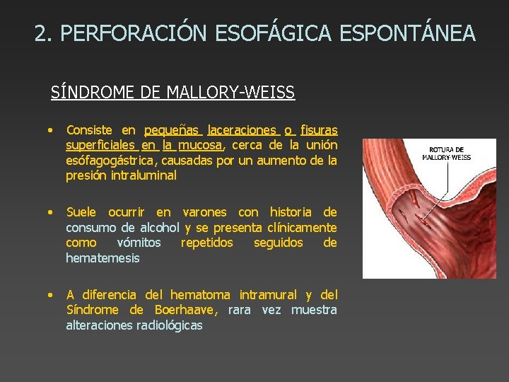 2. PERFORACIÓN ESOFÁGICA ESPONTÁNEA SÍNDROME DE MALLORY-WEISS • Consiste en pequeñas laceraciones o fisuras