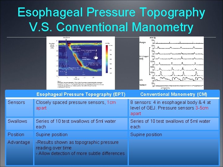 Esophageal Pressure Topography V. S. Conventional Manometry Esophageal Pressure Topography (EPT) Conventional Manometry (CM)