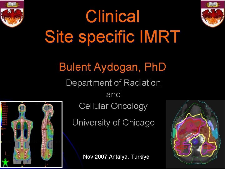 Clinical Site specific IMRT Bulent Aydogan, Ph. D Department of Radiation and Cellular Oncology