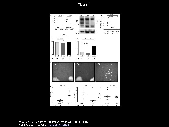 Figure 1 Kidney International 2019 951138 -1152 DOI: (10. 1016/j. kint. 2018. 11. 040)