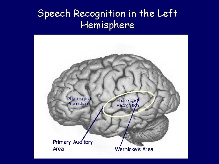 Speech Recognition in the Left Hemisphere Phonological Production Primary Auditory Area Phonological Recognition Wernicke’s