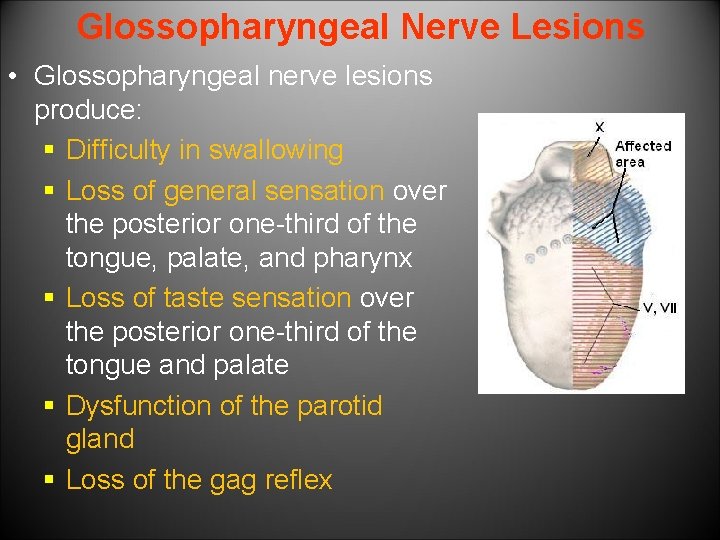 Glossopharyngeal Nerve Lesions • Glossopharyngeal nerve lesions produce: § Difficulty in swallowing § Loss