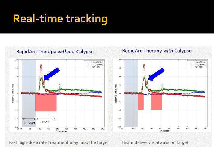 Real-time tracking 