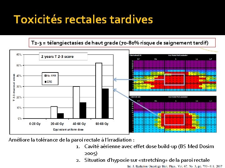 Toxicités rectales tardives T 2 -3 = télangiectasies de haut grade (70 -80% risque