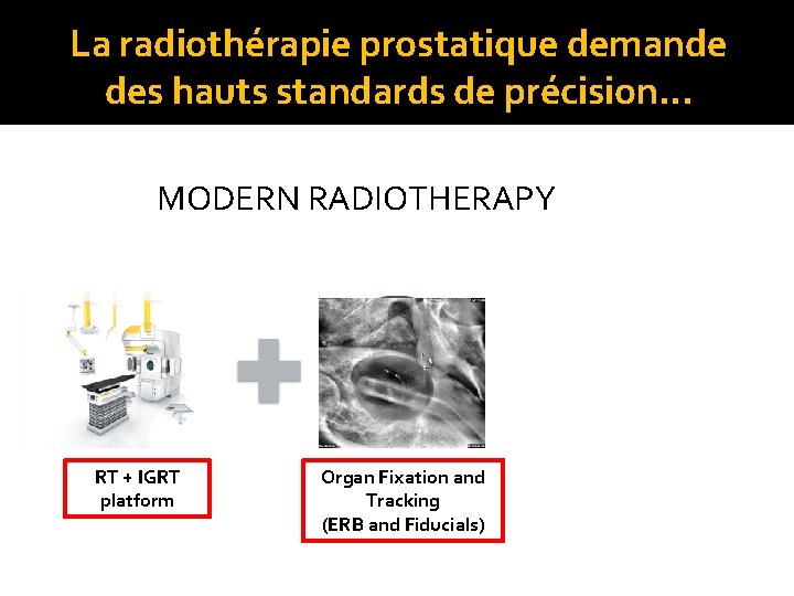 La radiothérapie prostatique demande des hauts standards de précision… MODERN RADIOTHERAPY RT + IGRT