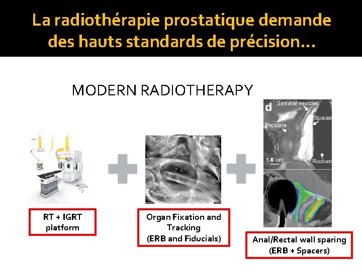 La radiothérapie prostatique demande des hauts standards de précision… MODERN RADIOTHERAPY RT + IGRT