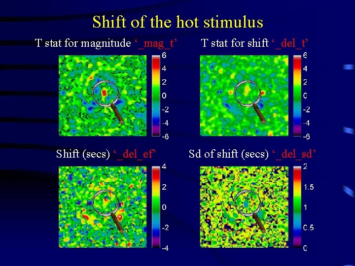 Shift of the hot stimulus T stat for magnitude ‘_mag_t’ T stat for shift