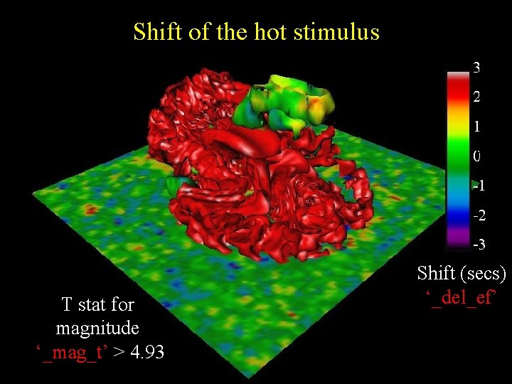 Shift of the hot stimulus T stat for magnitude ‘_mag_t’ > 4. 93 Shift