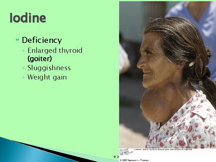 Iodine Deficiency ◦ Enlarged thyroid (goiter) ◦ Sluggishness ◦ Weight gain © 2006 Thomson-Wadsworth Iodine Deficiency ◦ Enlarged thyroid (goiter) ◦ Sluggishness ◦ Weight gain © 2006 Thomson-Wadsworth