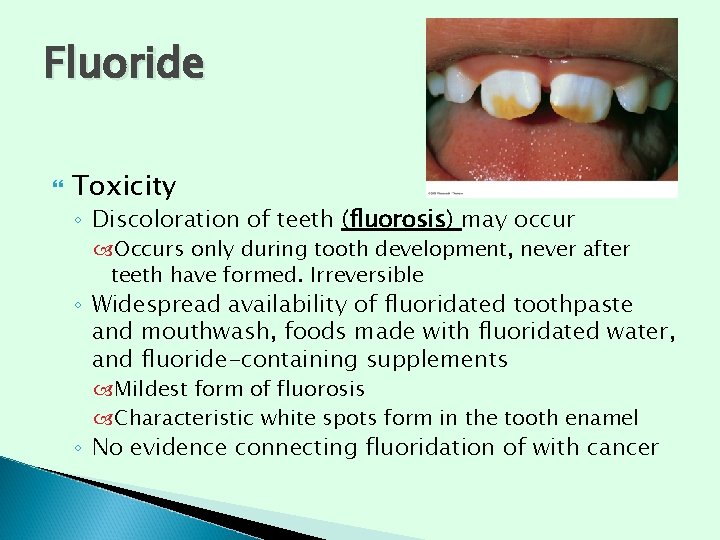 Fluoride Toxicity ◦ Discoloration of teeth (fluorosis) may occur Occurs only during tooth development, Fluoride Toxicity ◦ Discoloration of teeth (fluorosis) may occur Occurs only during tooth development,