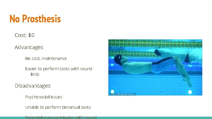 No Prosthesis Cost: $0 Advantages No cost, maintenance Easier to perform tasks with sound