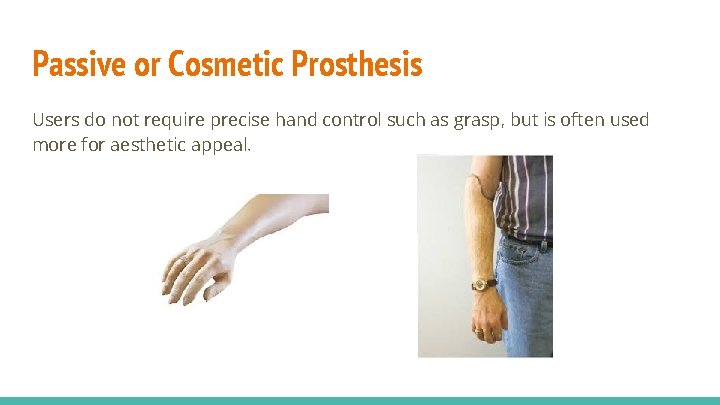 Passive or Cosmetic Prosthesis Users do not require precise hand control such as grasp,