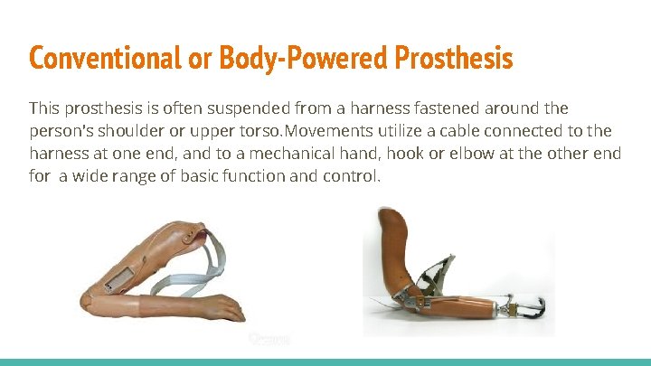 Conventional or Body-Powered Prosthesis This prosthesis is often suspended from a harness fastened around