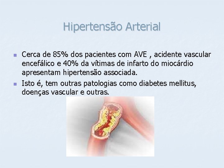 Hipertensão Arterial n n Cerca de 85% dos pacientes com AVE , acidente vascular