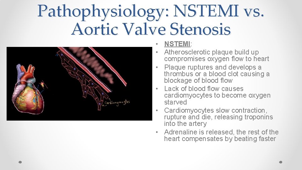 Pathophysiology: NSTEMI vs. Aortic Valve Stenosis • NSTEMI: • Atherosclerotic plaque build up compromises