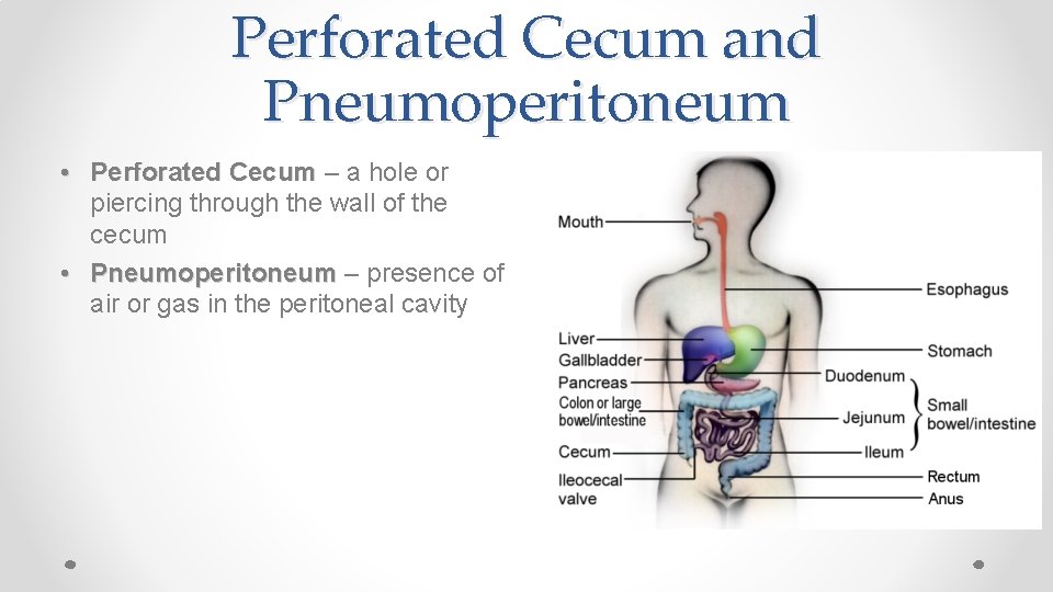 Perforated Cecum and Pneumoperitoneum • Perforated Cecum – a hole or piercing through the