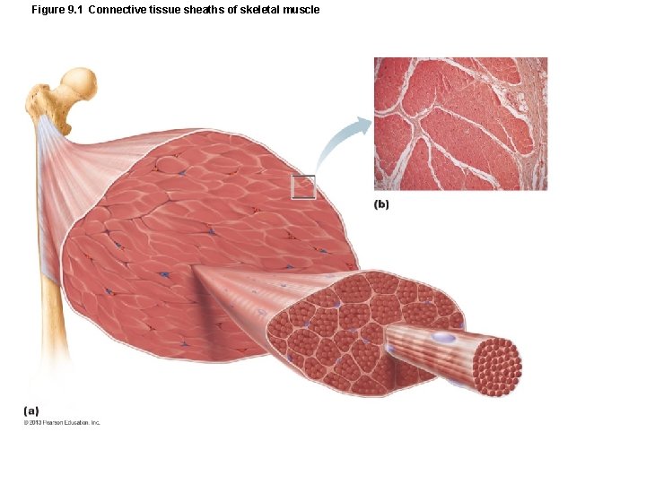 Figure 9. 1 Connective tissue sheaths of skeletal muscle Figure 9. 1 Connective tissue sheaths of skeletal muscle