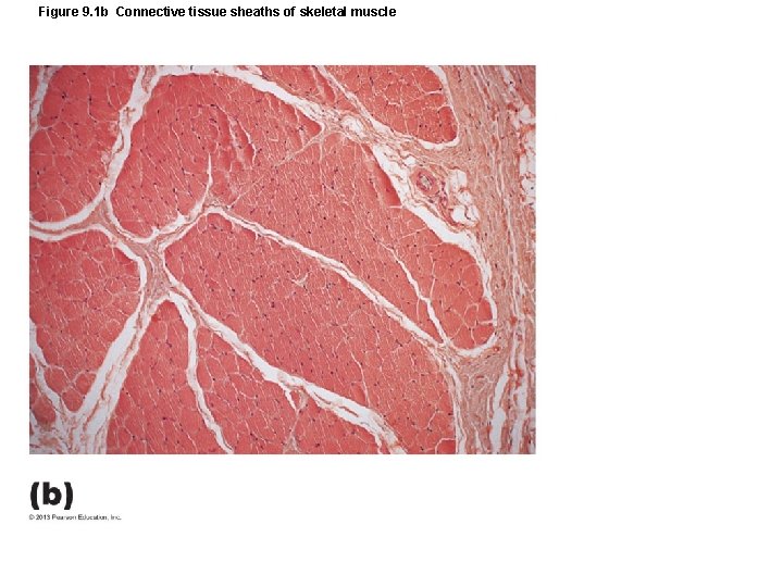 Figure 9. 1 b Connective tissue sheaths of skeletal muscle Figure 9. 1 b Connective tissue sheaths of skeletal muscle