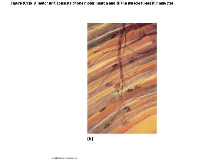 Figure 9. 13 b A motor unit consists of one motor neuron and all Figure 9. 13 b A motor unit consists of one motor neuron and all