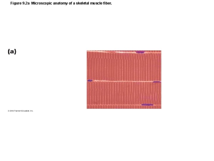 Figure 9. 2 a Microscopic anatomy of a skeletal muscle fiber. Figure 9. 2 a Microscopic anatomy of a skeletal muscle fiber.