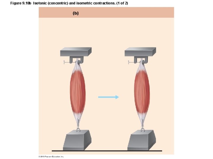Figure 9. 18 b Isotonic (concentric) and isometric contractions. (1 of 2) Figure 9. 18 b Isotonic (concentric) and isometric contractions. (1 of 2)
